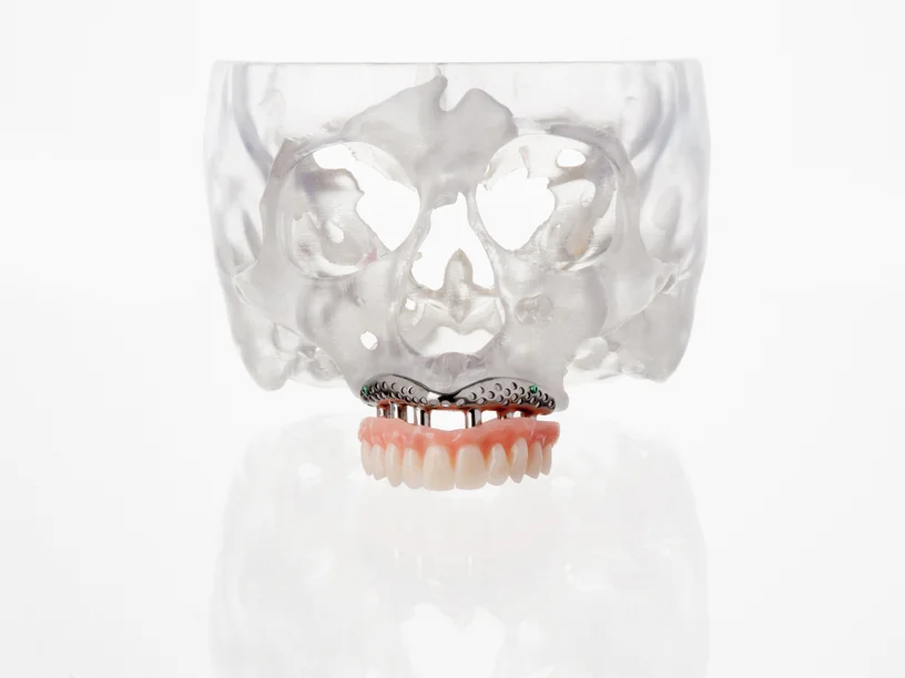 3d_printer_craniomaxillofacial-surgery_osseo-frame_omx (1).webp